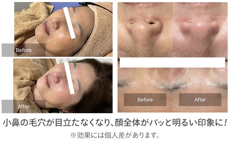 ビフォーアフター